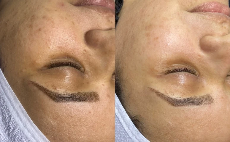 Gleyce Noda – Estética e Lash Designer – Ibiúna SP
