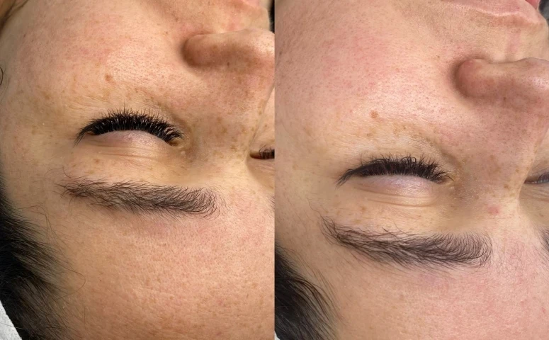 Gleyce Noda – Estética e Lash Designer – Ibiúna SP