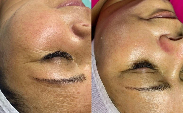 Gleyce Noda – Estética e Lash Designer – Ibiúna SP